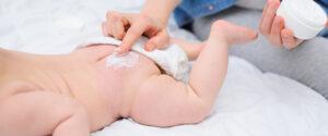 How-To-Prevent-Diaper-Rash-Babies