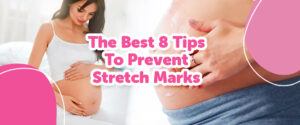 Best tips to prevent stretch marks