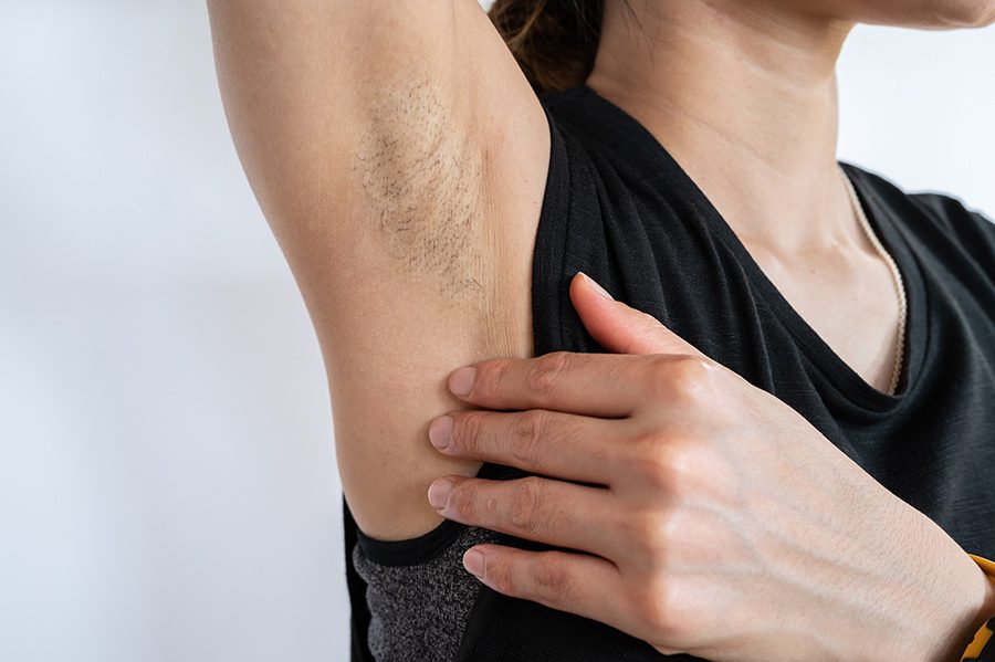 underarm-problems-and-solutions-chicken-skin