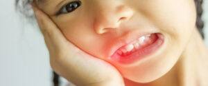 common-dental-problems-kids