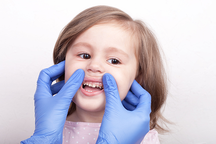 dental-problems-in-children-gum-disease