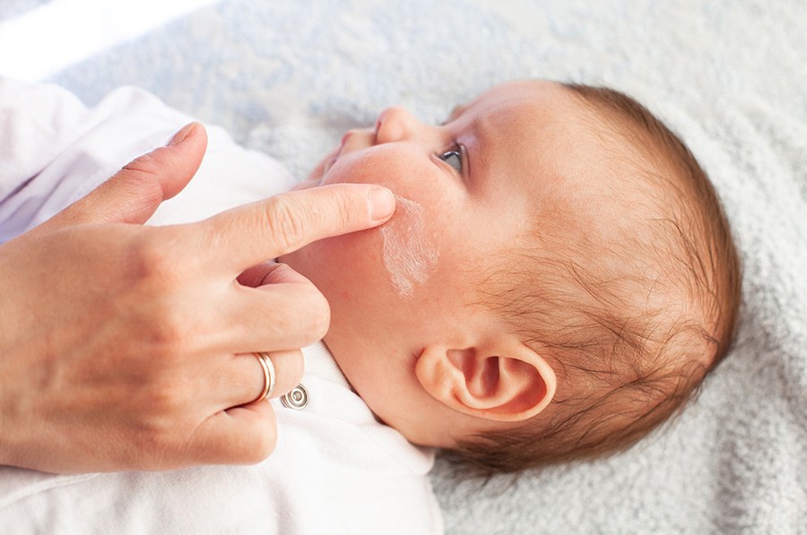 why-do-babies-need-moisturiser