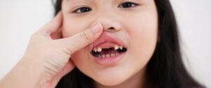 swollen gums in kids singapore